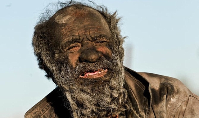 70 yıldır yıkanmayan adam, yıkandıktan sonra öldü