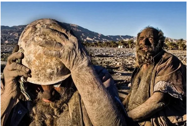 70 yıldır yıkanmayan adam, yıkandıktan sonra öldü