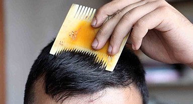 Sivas kemik tarağı coğrafi işaret tescili aldı