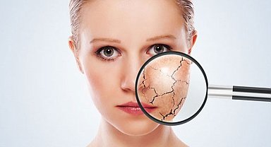 Hava sıcaklıkları artıyor, cilt kuruluğu olanlar nasıl önlemler almalı