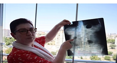 22 yıldır karnında ameliyat iğnesiyle yaşıyor